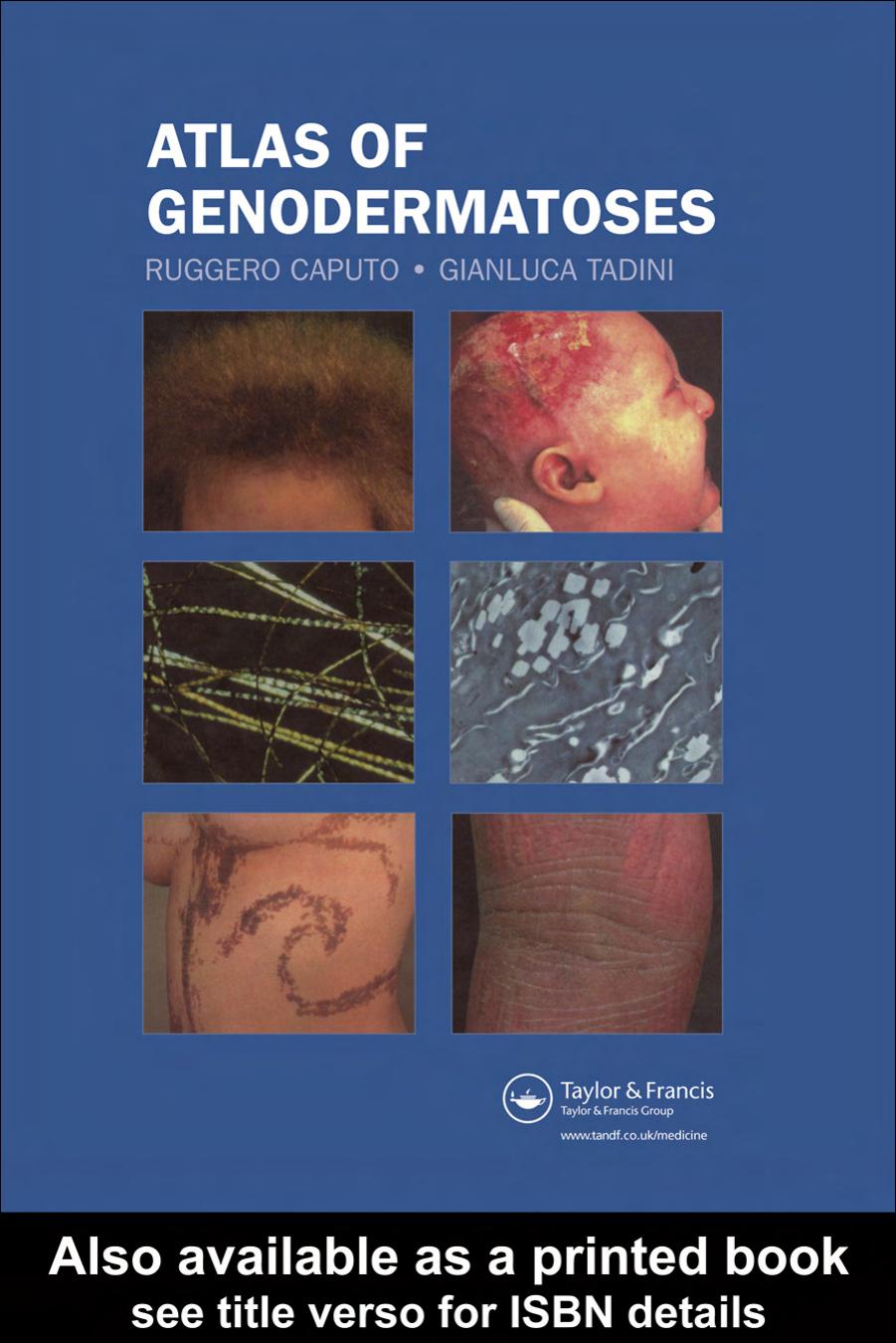 Atlas of Genodermatoses by Ruggero Caputo