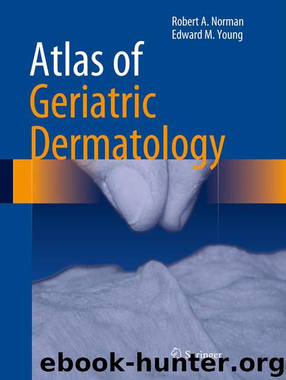 Atlas of Geriatric Dermatology by Robert A. Norman & Edward M. Young Jr