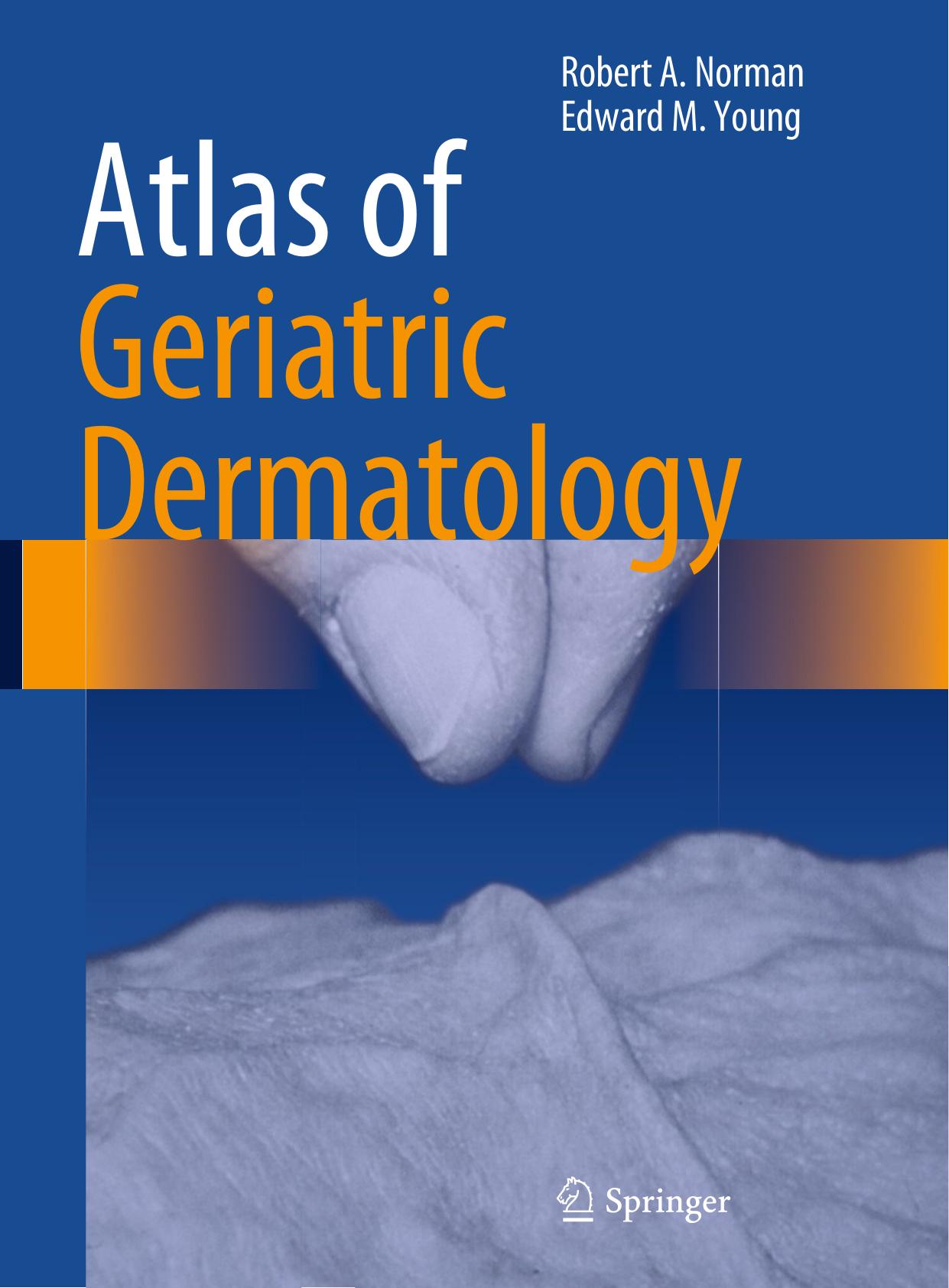 Atlas of Geriatric Dermatology by Robert A. Norman Edward M. Young Jr (auth.)