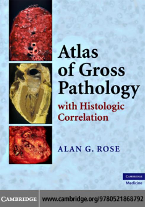 Atlas of Gross Pathology: With Histologic Correlation by Alan G. Rose