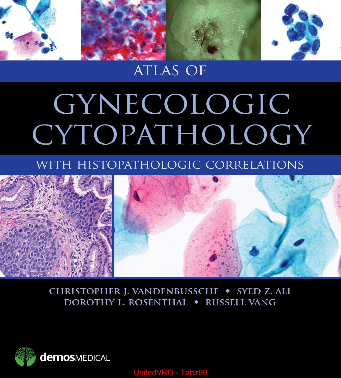 Atlas of Gynecologic Cytopathology: with Histopathologic Correlations by unknow