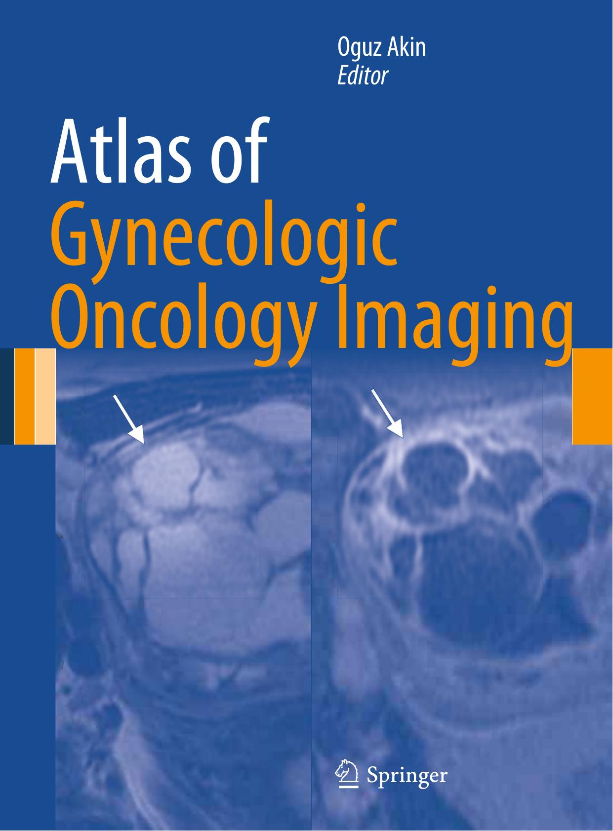 Atlas of Gynecologic Oncology Imaging by Oguz Akin (editor)