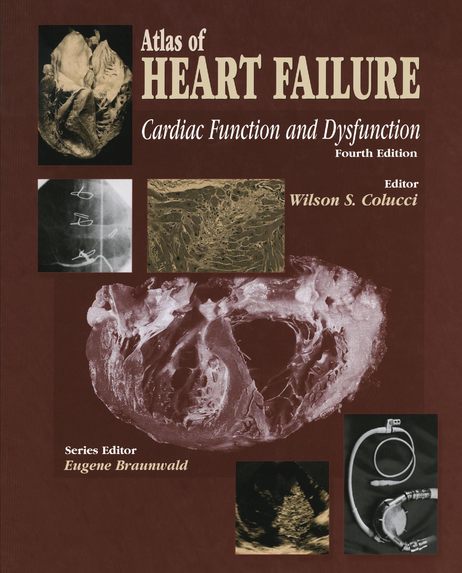 Atlas of HEART FAILURE: Cardiac Function and Dysfunction by Arnold M. Katz (auth.) Wilson S. Colucci MD (eds.)