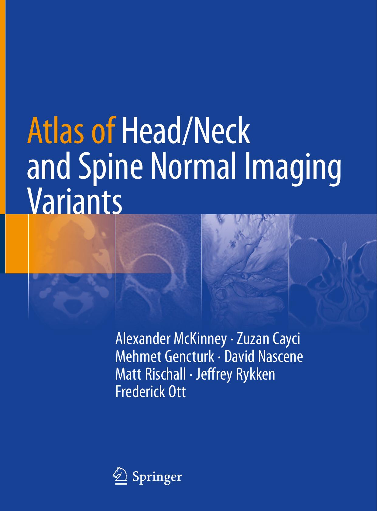 Atlas of Head/Neck and Spine Normal Imaging Variants by unknow