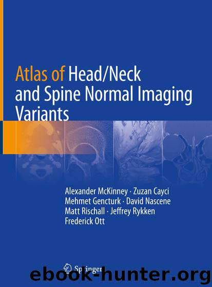 Atlas of HeadNeck and Spine Normal Imaging Variants by unknow