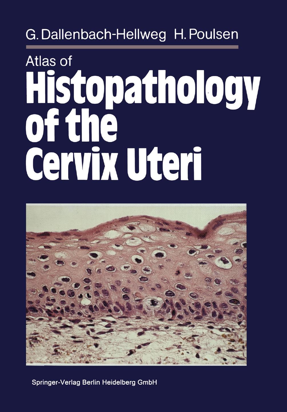 Atlas of Histopathology of the Cervix Uteri by Dr. Gisela Dallenbach-Hellweg Dr. Hemming Poulsen (auth.)