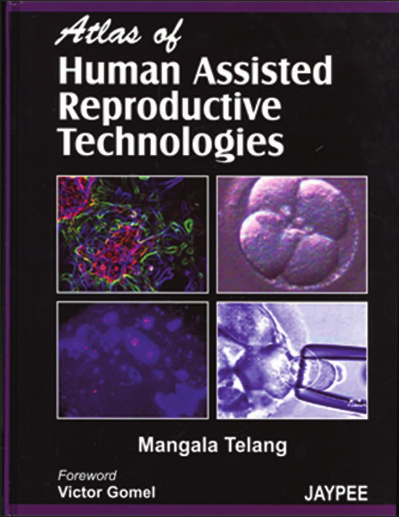 Atlas of Human Assisted Reproductive Technologies by Margala Telang (editor)