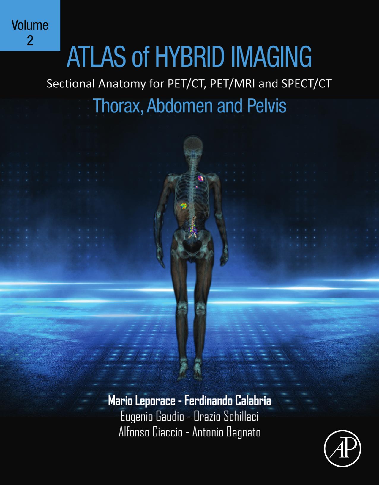 Atlas of Hybrid Imaging Sectional Anatomy for PET/CT, PET/MRI and SPECT/CT Vol. 2: Thorax Abdomen and Pelvis: Sectional Anatomy for PET/CT, PET/MRI and SPECT/CT by unknow