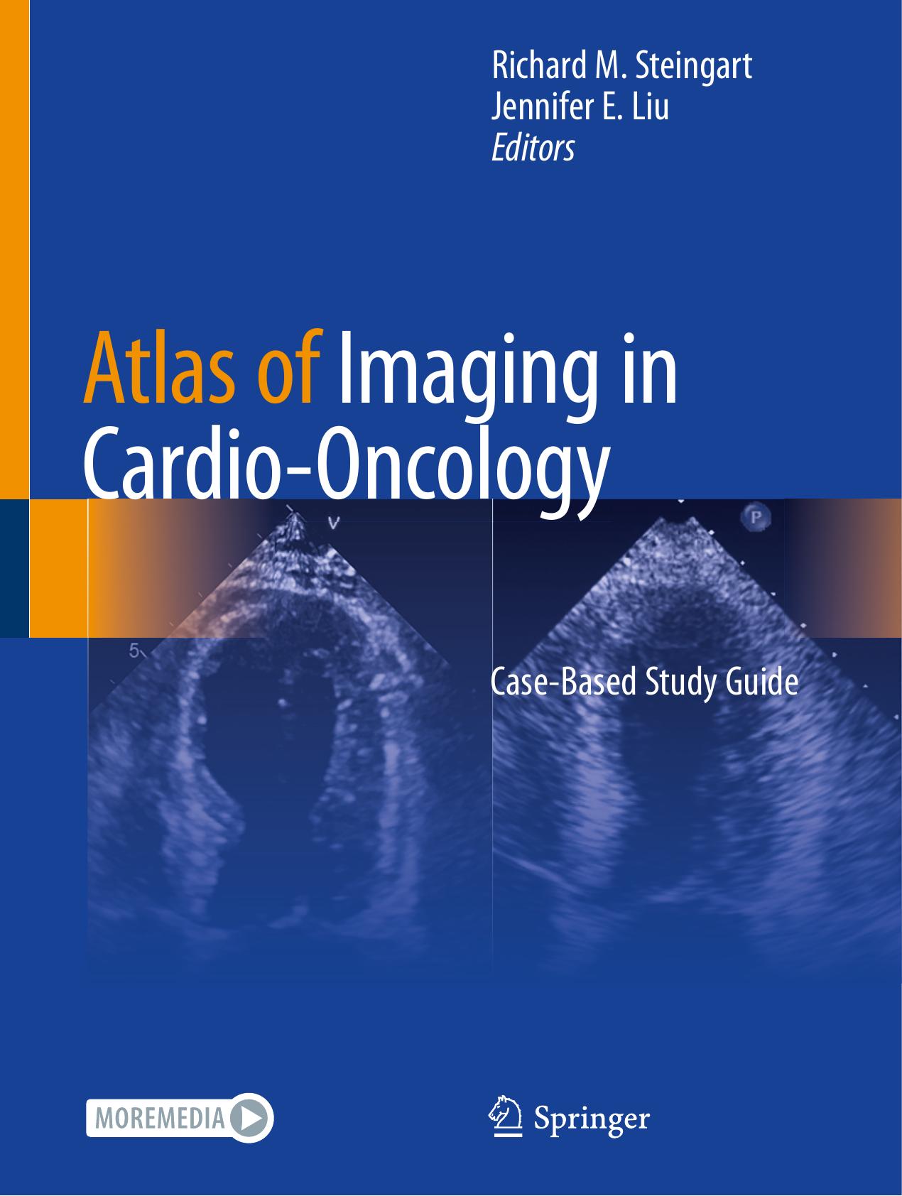Atlas of Imaging in Cardio-Oncology: Case-Based Study Guide by Richard M. Steingart (editor) Jennifer E. Liu (editor)