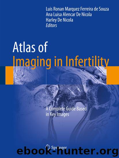 Atlas of Imaging in Infertility by Luis Ronan Marquez Ferreira de Souza Ana Luisa Alencar De Nicola & Harley De Nicola