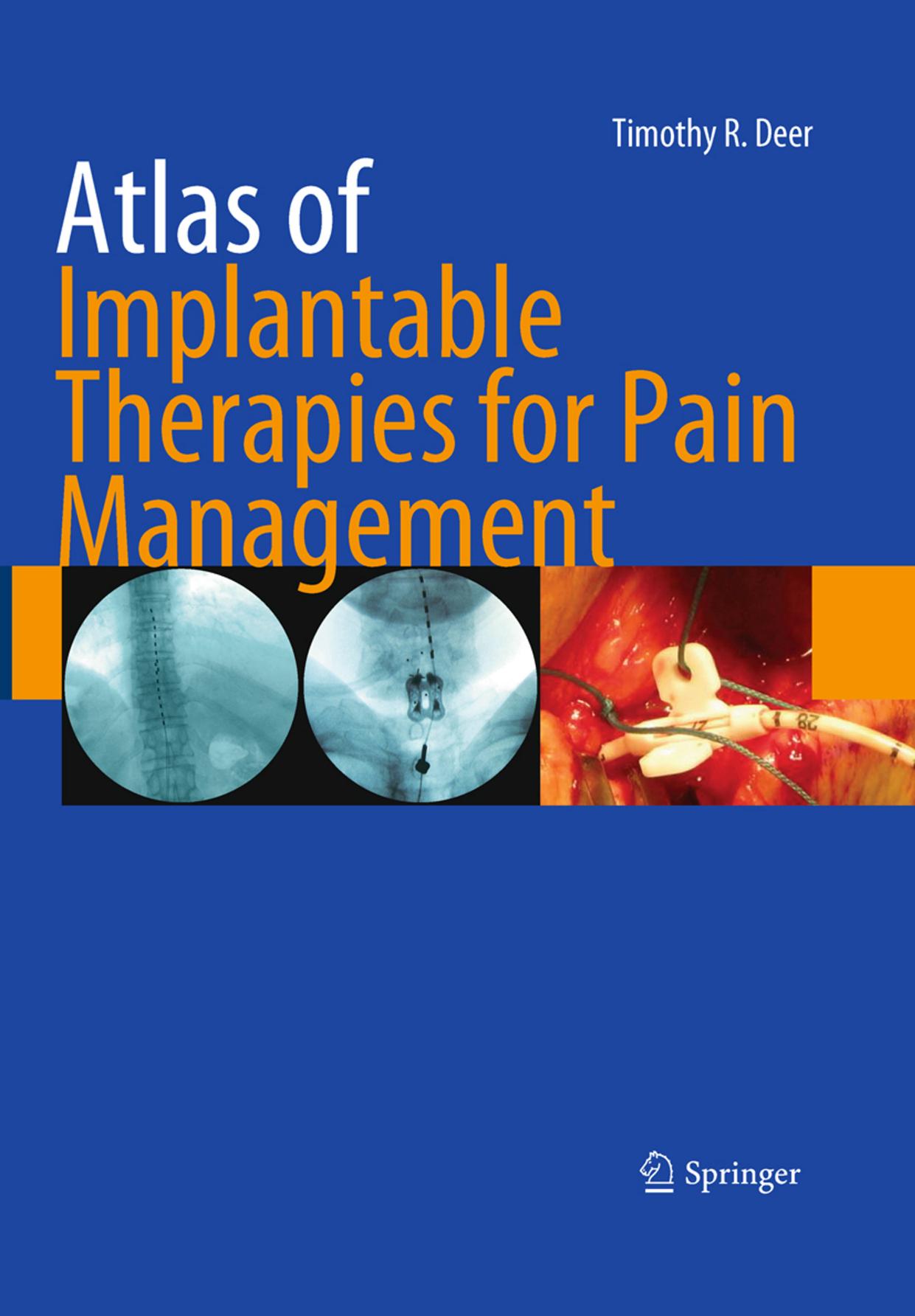 Atlas of Implantable Therapies for Pain Management by Timothy R. Deer (auth.)