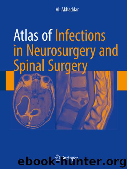 Atlas of Infections in Neurosurgery and Spinal Surgery by Ali Akhaddar
