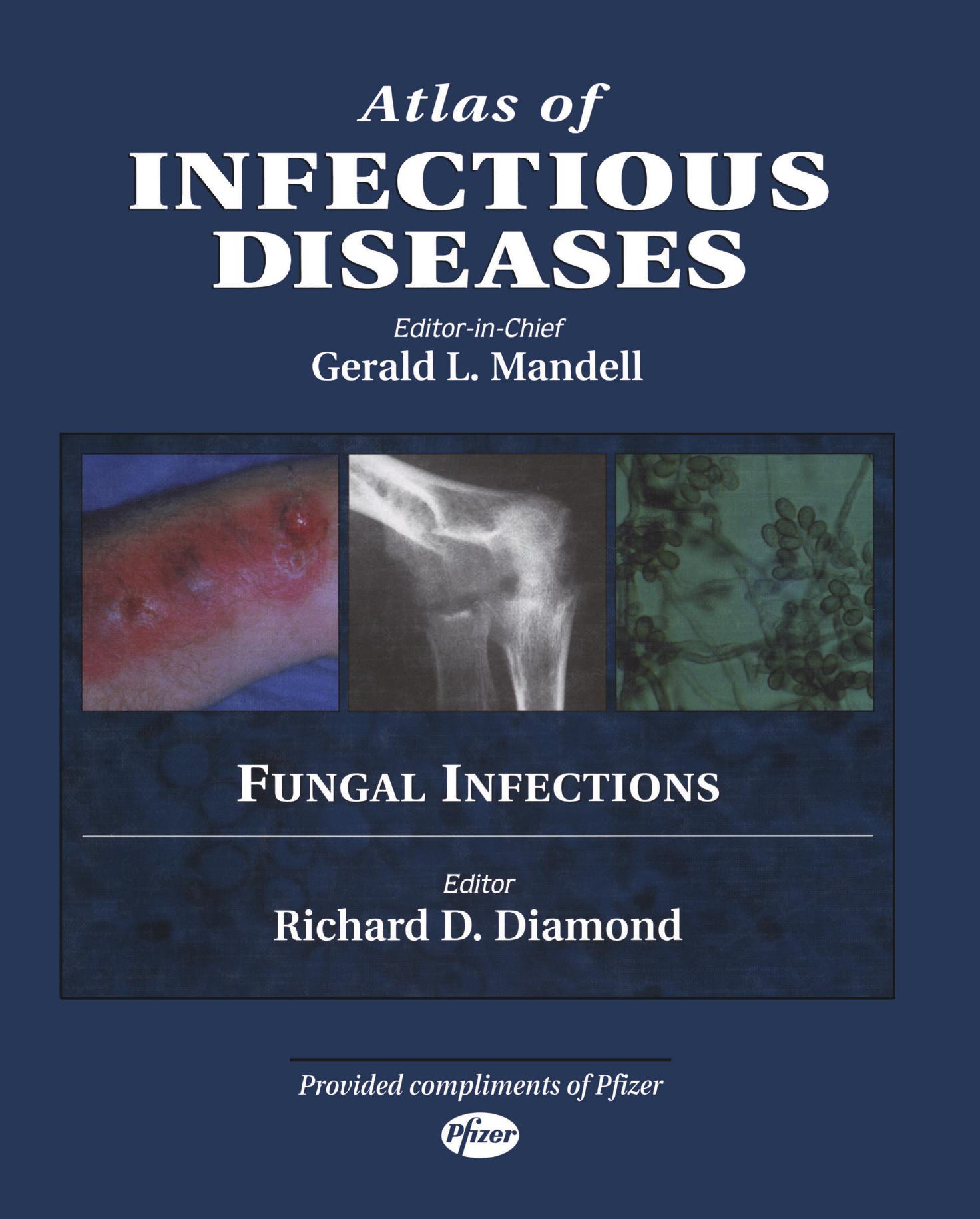 Atlas of Infectious Diseases: Fungal Infections by Unknow