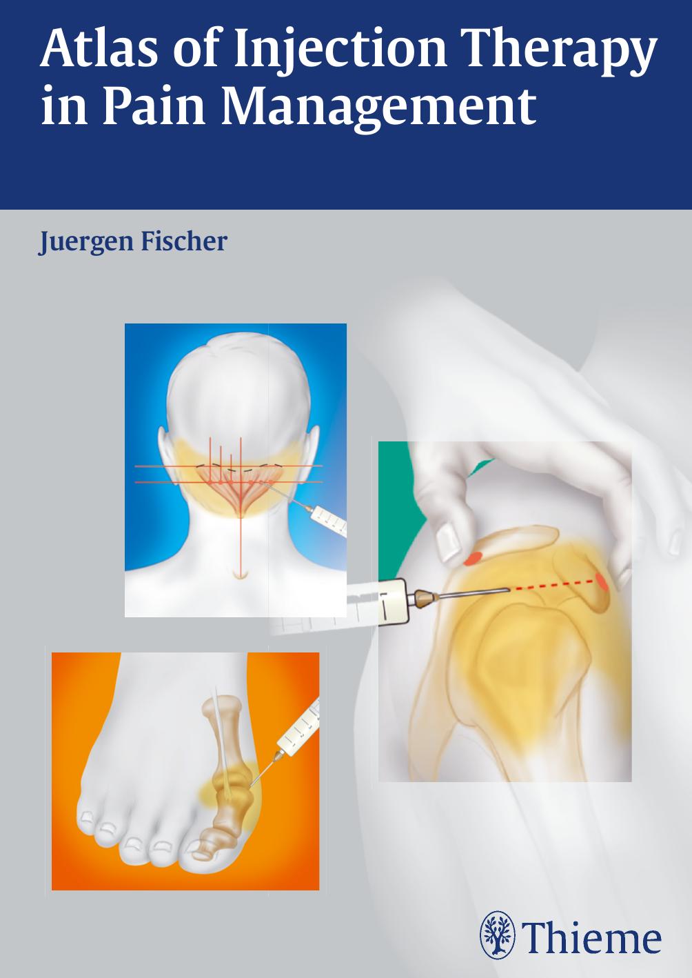 Atlas of Injection Therapy in Pain Management by Juergen Fischer