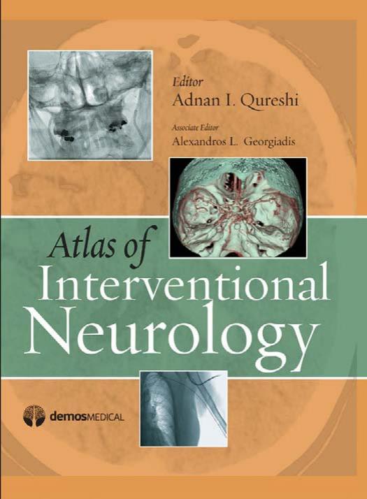 Atlas of Interventional Neurology by Adnan Qureshi