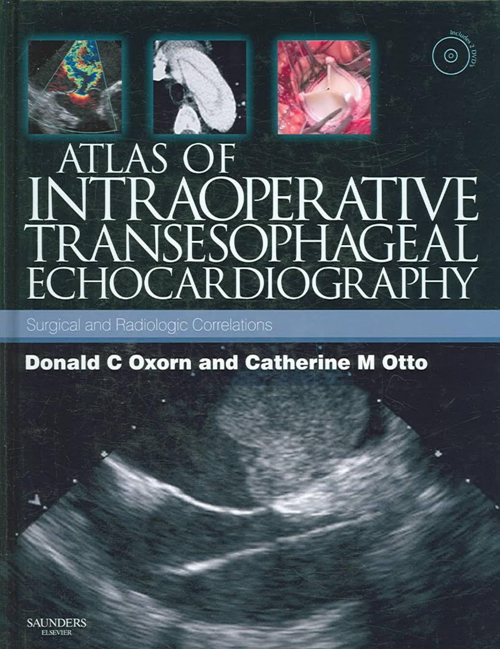 Atlas of Intraoperative Transesophageal Echocardiography by Donald C. Oxorn Catherine M. Otto