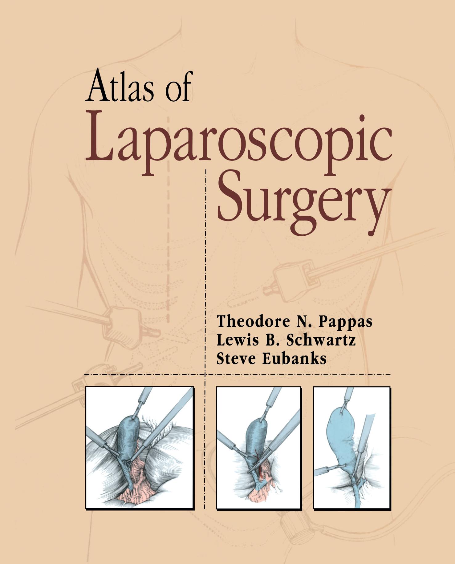 Atlas of Laparoscopic Surgery by Theodore N. Pappas Lewis B. Schwartz Steve Eubanks (auth.)