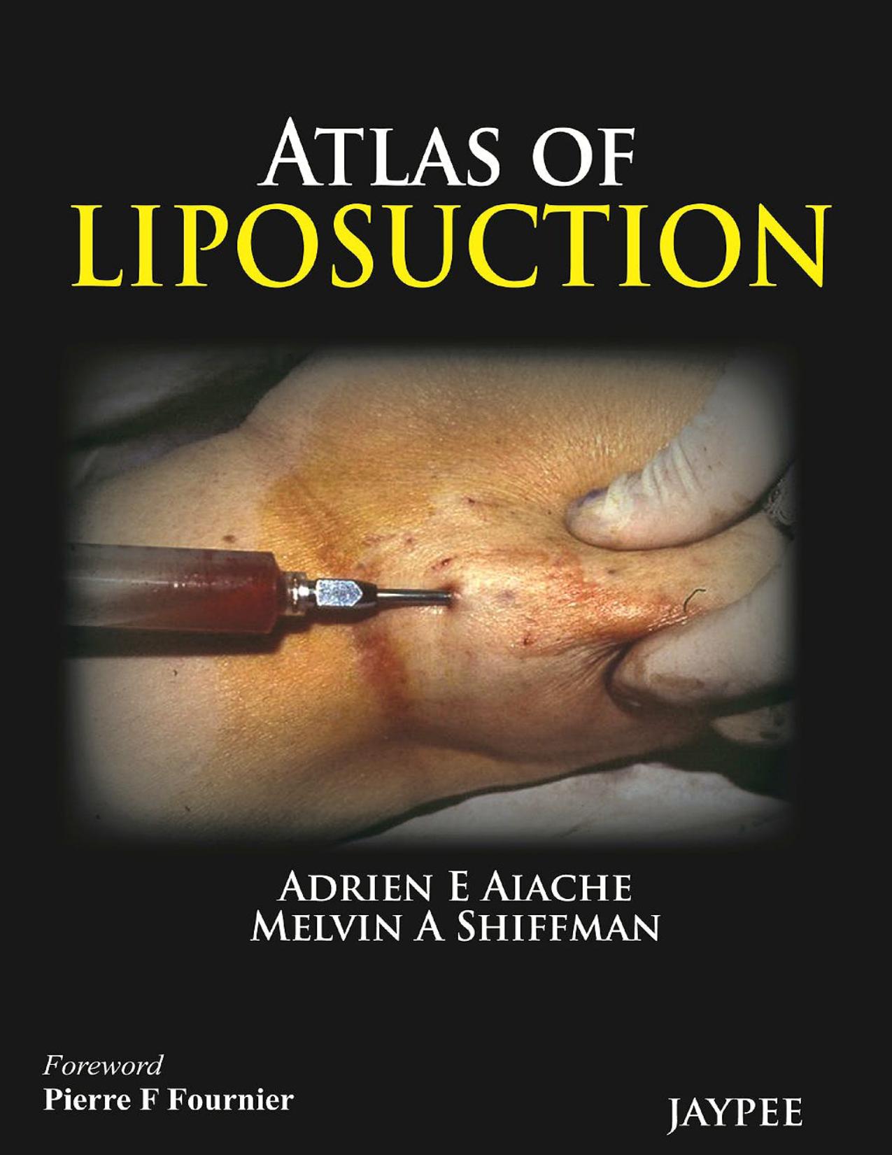 Atlas of Liposuction by Adrien E. Aiache; Melvin A. Shiffman