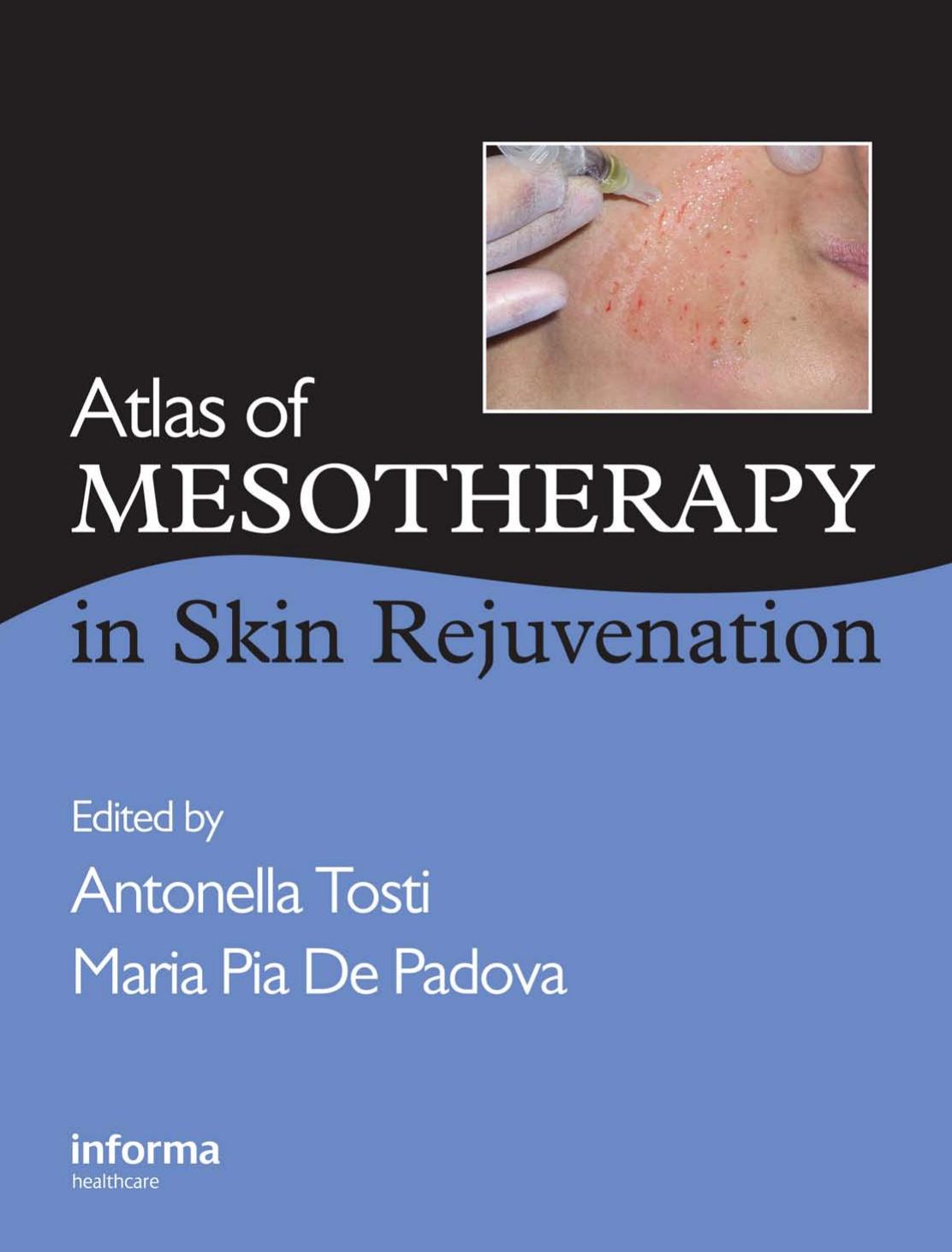 Atlas of Mesotherapy in Skin Rejuvenation by Antonella Tosti Maria De Padova