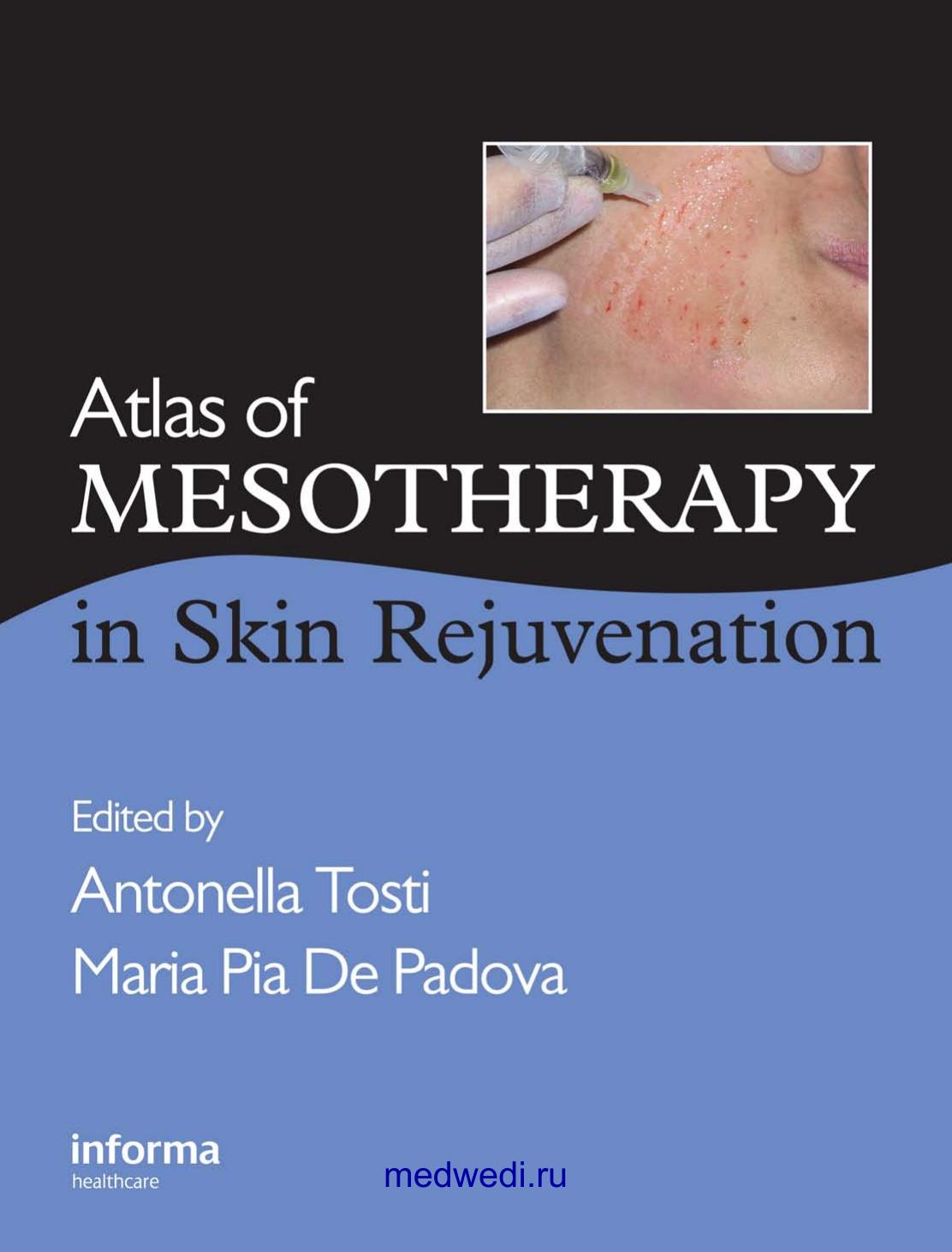 Atlas of Mesotherapy in Skin Rejuvenation by Tosti A.(Ed.) De Padova M. (Ed.)