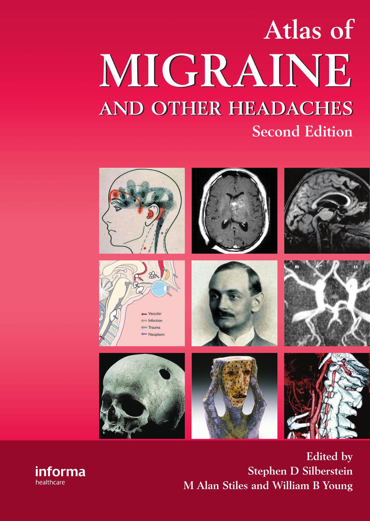 Atlas of Migraine and Other Headaches by Stephen D. Silberstein