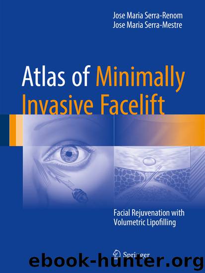 Atlas of Minimally Invasive Facelift by Jose Maria Serra-Renom & Jose Maria Serra-Mestre