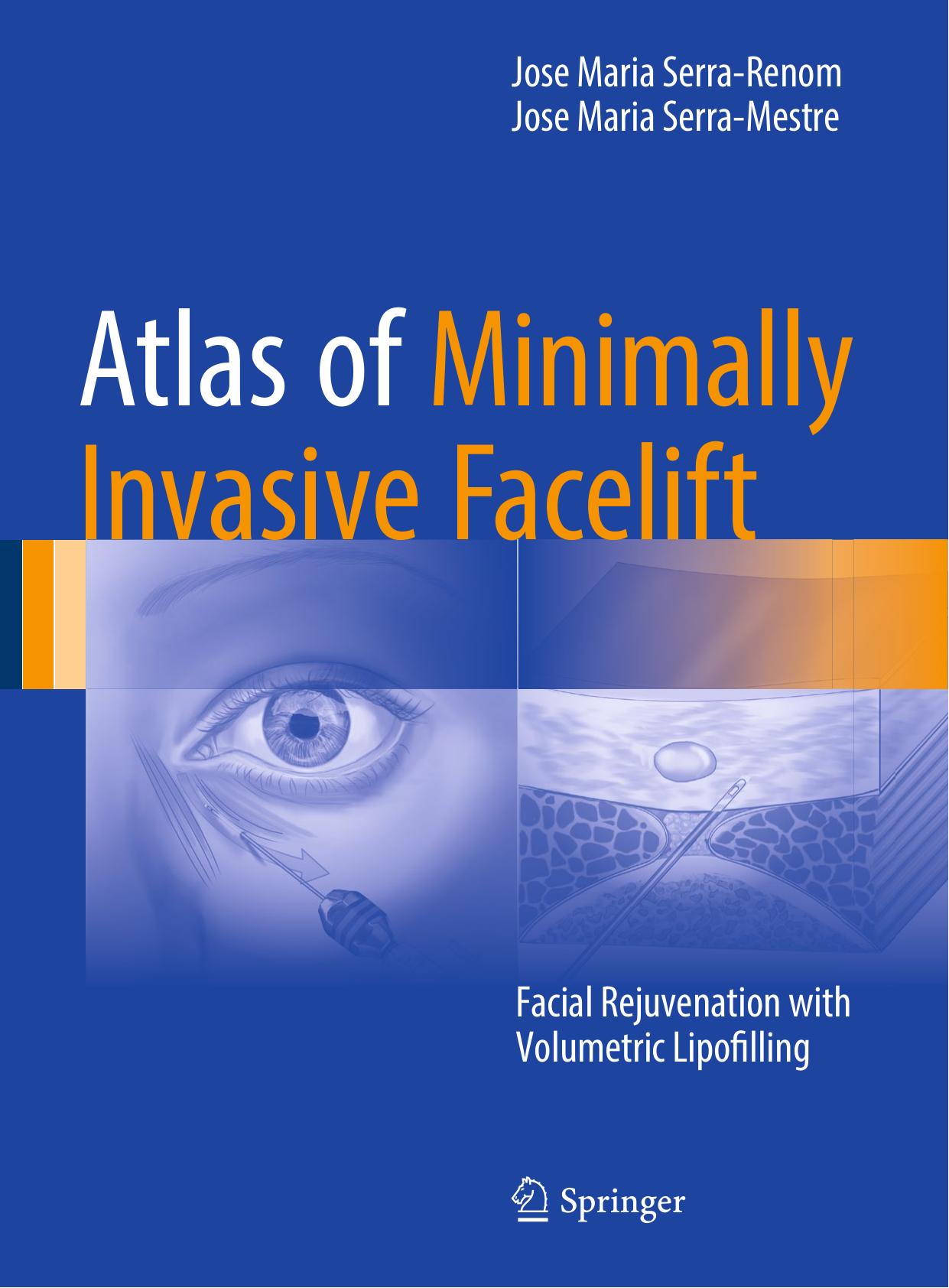 Atlas of Minimally Invasive Facelift: Facial Rejuvenation with Volumetric Lipofilling by Unknow