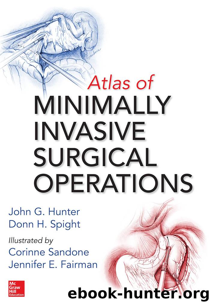 Atlas of Minimally Invasive Surgical Operations by John G. Hunter Donn H. Spight Corinne Sandone Jennifer E. Fairman