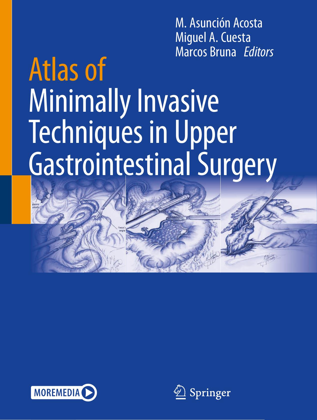 Atlas of Minimally Invasive Techniques in Upper Gastrointestinal Surgery by M. Asunción Acosta Miguel A. Cuesta Marcos Bruna (ed.)