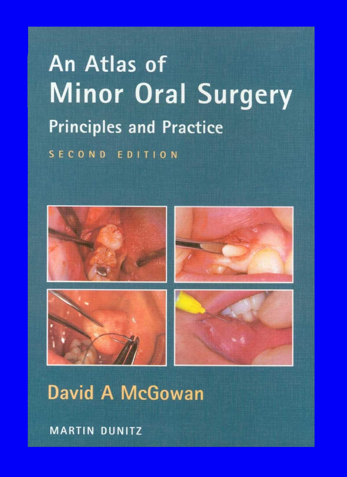 Atlas of Minor Oral Surgery: Principles and Practice by David A. McGowan