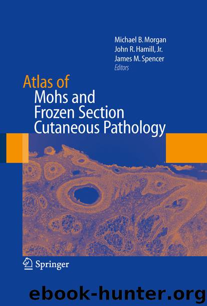 Atlas of Mohs and Frozen Section Cutaneous Pathology by Michael Morgan John R. Hamill & James M. Spencer