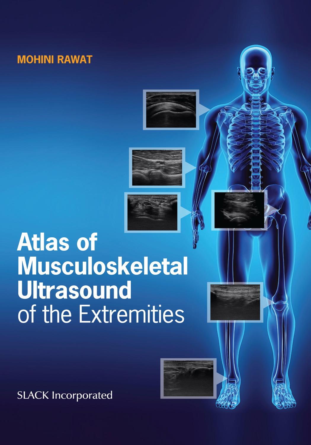 Atlas of Musculoskeletal Ultrasound of the Extremities by Dr. Mohini Rawat