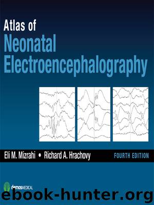 Atlas of Neonatal Electroencephalography, Fourth Edition by Hrachovy Richard A. MD; Mizrahi Eli M. MD;