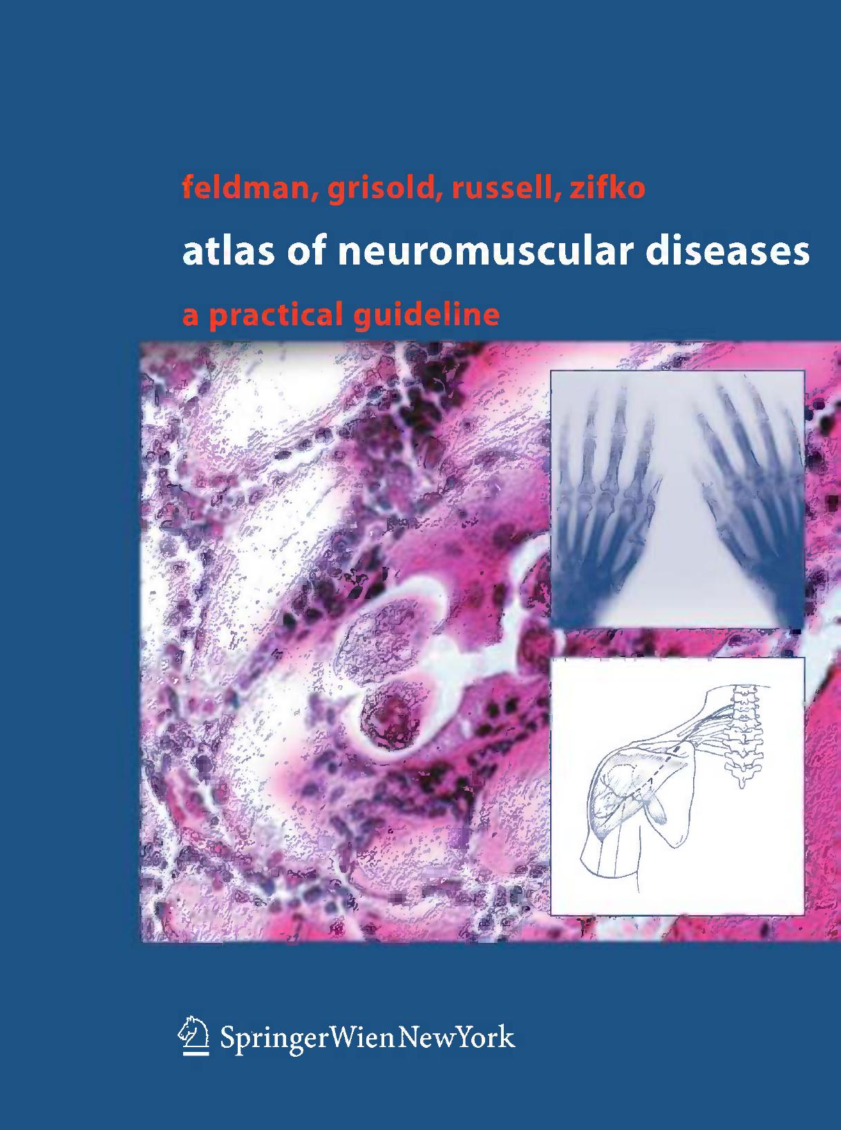 Atlas of Neuromuscular Diseases: A Practical Guideline by Eva L. Feldman Wolfgang Grisold James W. Russell Udo A. Zifko (auth.)
