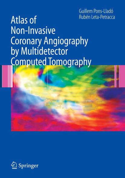 Atlas of Non Invasive Coronary Angiography by Multidetector Computed Tomography by Unknown