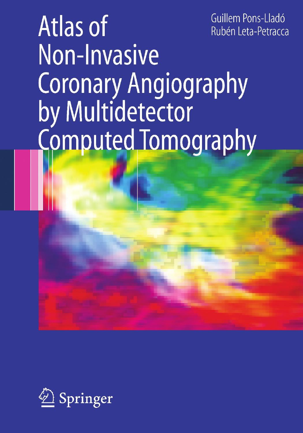 Atlas of Non-Invasive Coronary Angiography by Multidetector Computed Tomography by Guillem Pons-Lladó M.D. (auth.) Guillem Pons-Lladó M.D. Rubén Leta-Petracca M.D. (eds.)