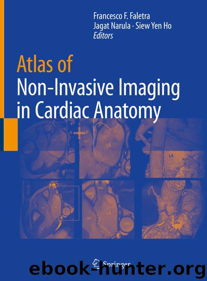 Atlas of Non-Invasive Imaging in Cardiac Anatomy by Unknown