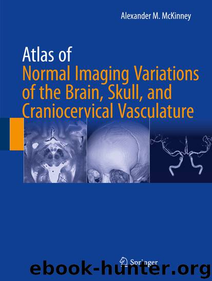 Atlas of Normal Imaging Variations of the Brain, Skull, and Craniocervical Vasculature by Alexander M. McKinney