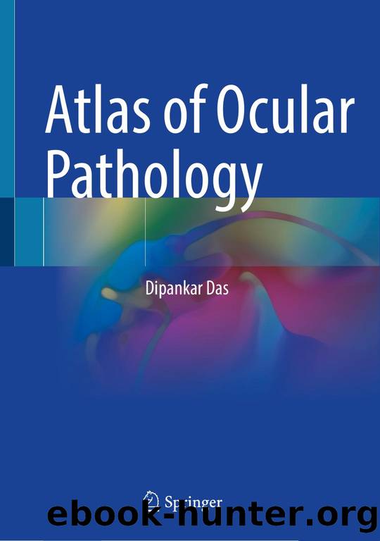 Atlas of Ocular Pathology by Unknown