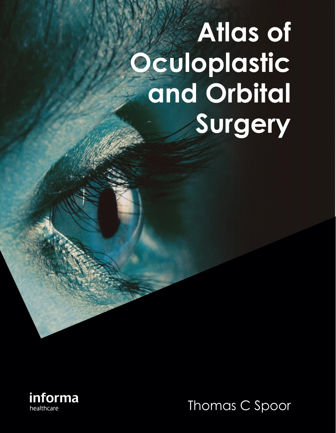 Atlas of Oculoplastic and Orbital Surgery by Thomas C. Spoor