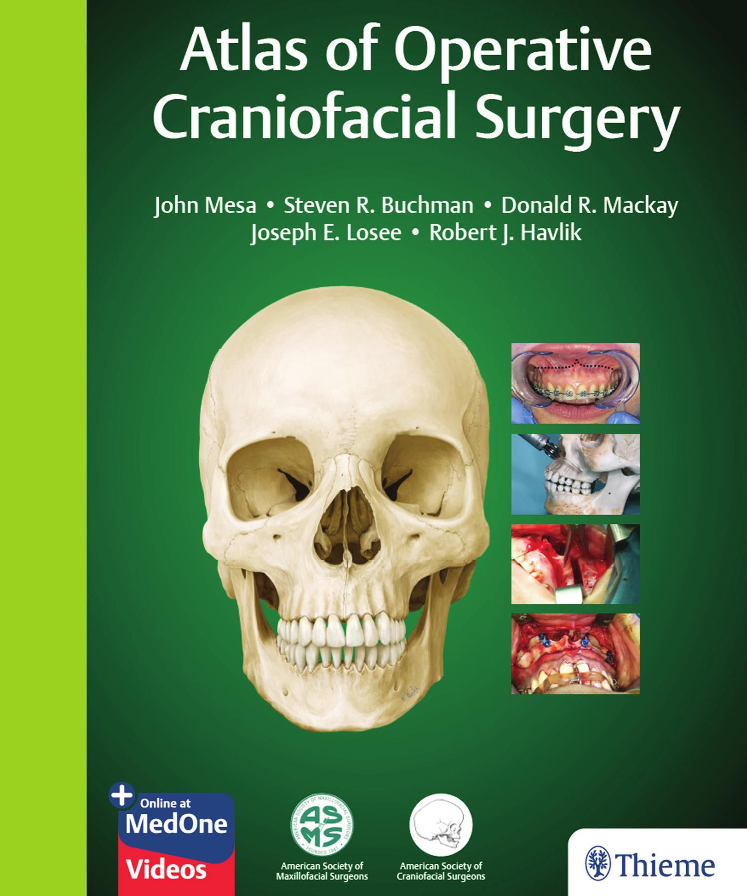 Atlas of Operative Craniofacial Surgery by John Mesa; Steven R. Buchman; Donald Mackay; Joseph Losee; Robert Havlik