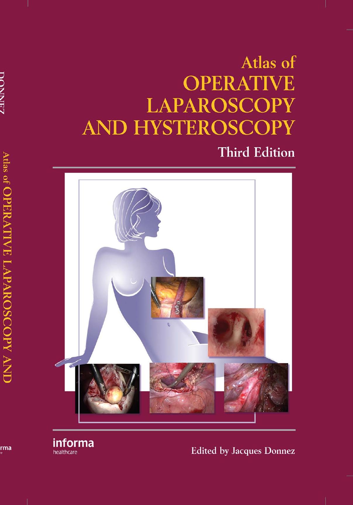 Atlas of Operative Laparoscopy and Hysteroscopy by Unknown