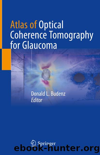 Atlas of Optical Coherence Tomography for Glaucoma by Unknown