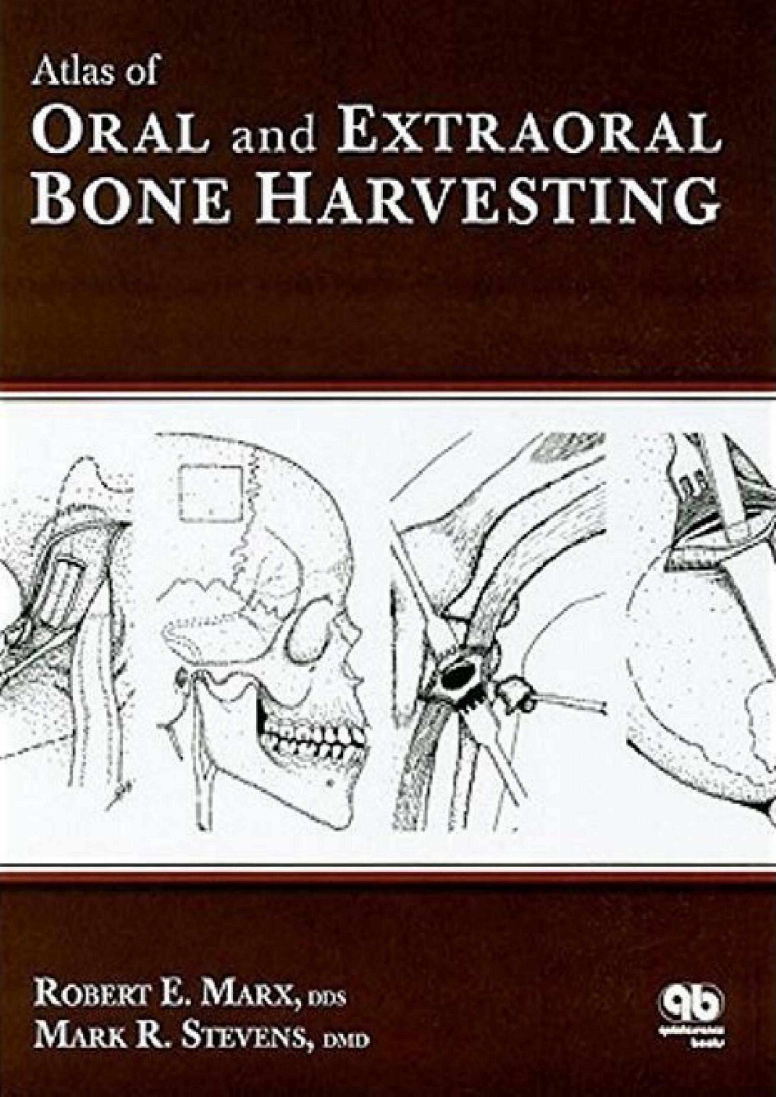 Atlas of Oral and Extraoral Bone Harvesting by Robert E. Marx Mark R. Stevens