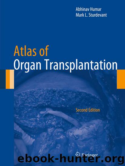 Atlas of Organ Transplantation by Abhinav Humar & Mark L. Sturdevant