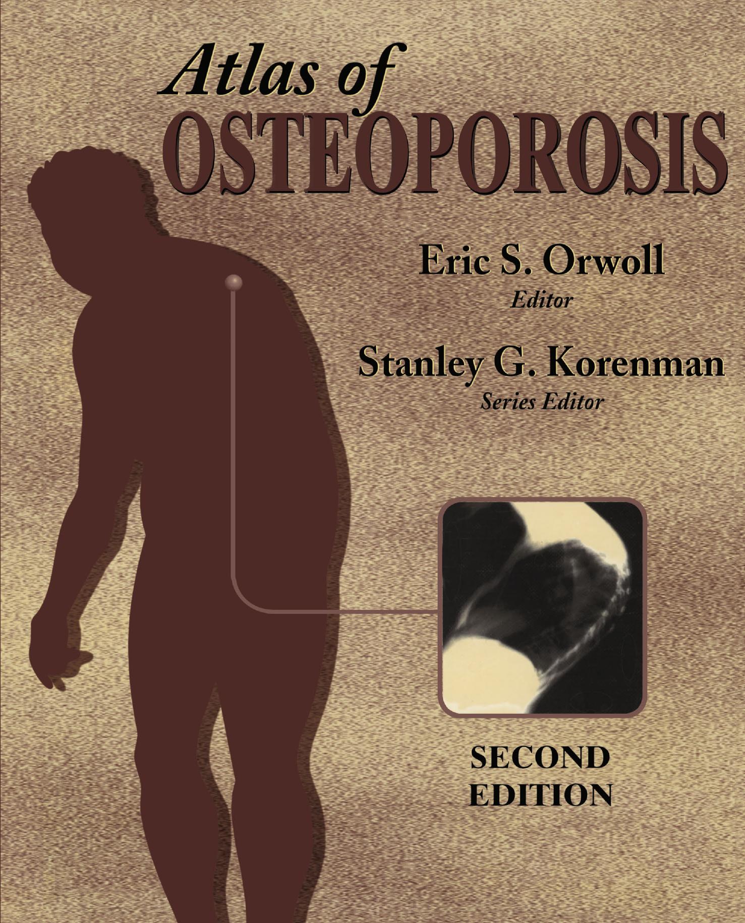 Atlas of Osteoporosis by Eric S. Orwoll Robert Marcus (auth.) Eric S. Orwoll MD (eds.)