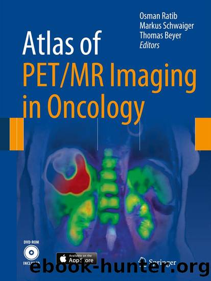 Atlas of PETMR Imaging in Oncology by Osman Ratib Markus Schwaiger & Thomas Beyer