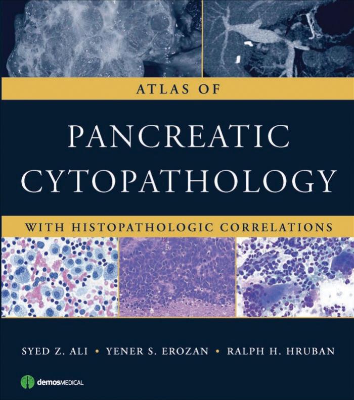 Atlas of Pancreatic Cytopathology: With Histopathologic Correlations by Syed Ali MD Yener Erozan MD Ralph Hruban MD
