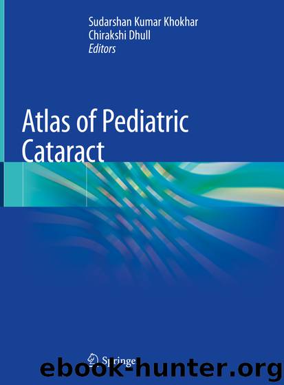 Atlas of Pediatric Cataract by Unknown