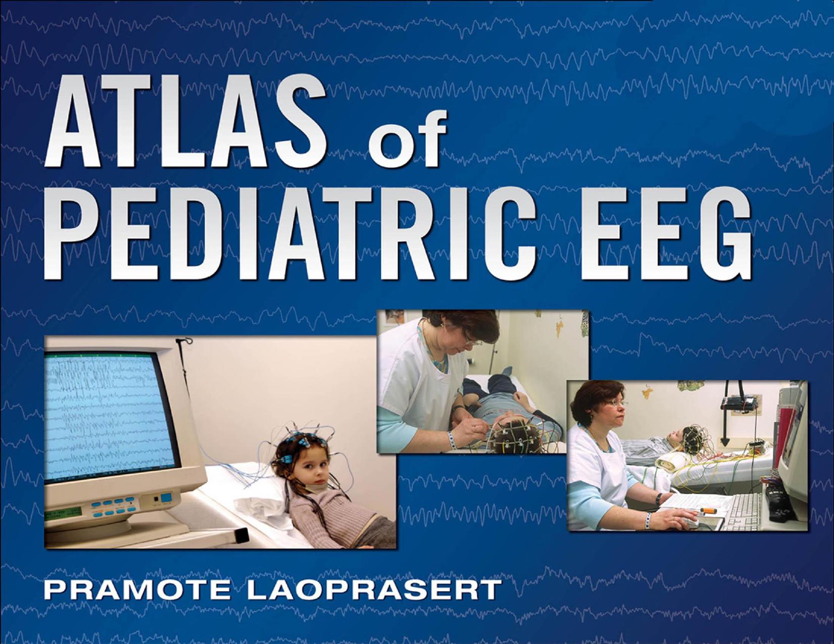 Atlas of Pediatric EEG by Laoprasert Pramote